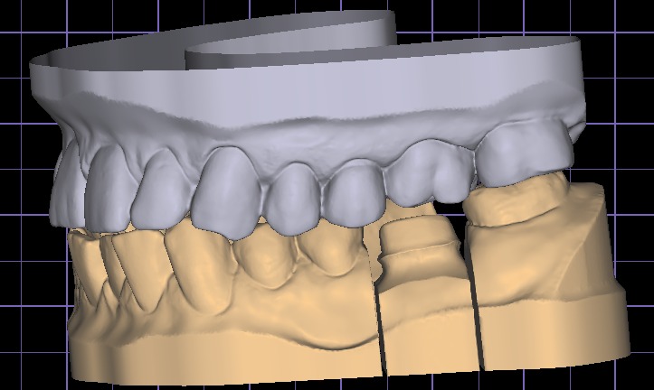 DIGITAL DIGITAL DENTISTRY