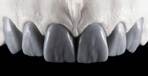 DIAGNOSING WAX