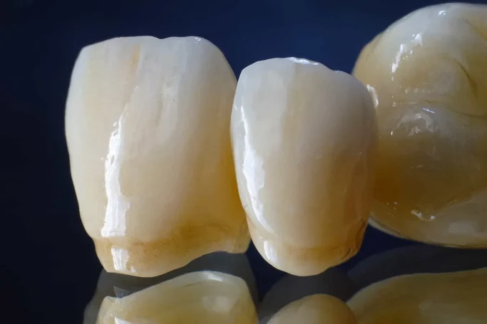 FULL CERAMIC BRIDGE